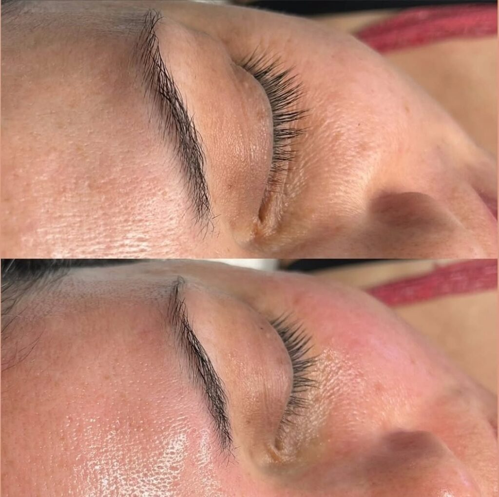 HydraFacial Glass Facial